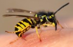 wasp sting